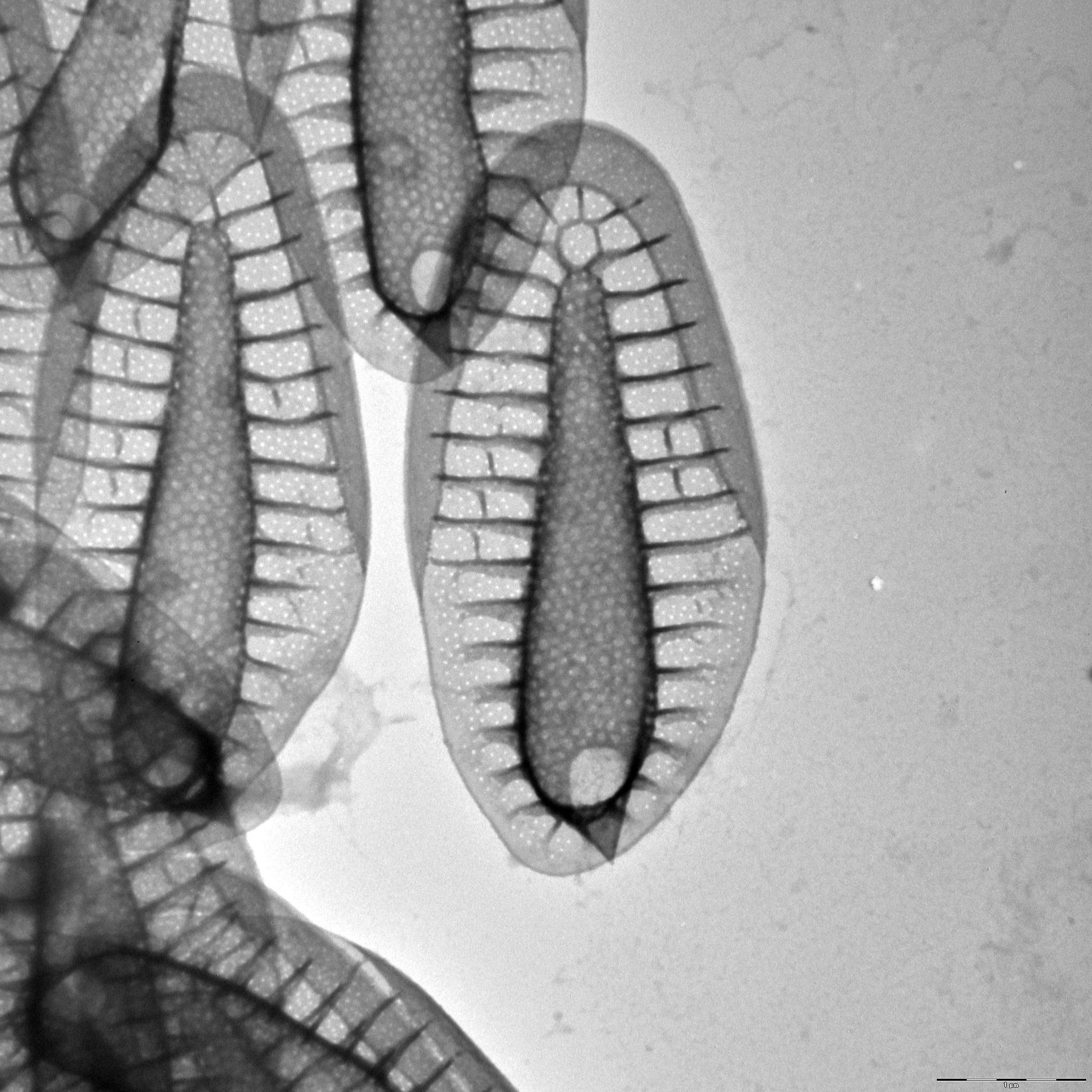 Synura borealis | Silica-scaled chrysophytes of Europe